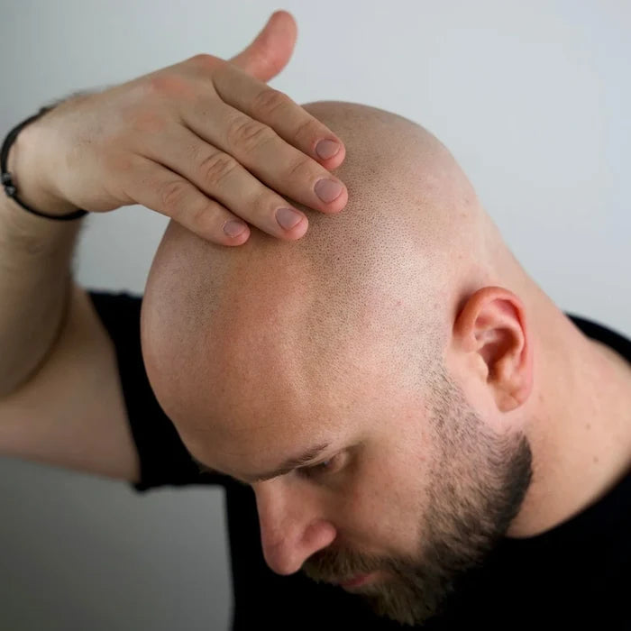Better Be Bold Kaal Hoofd Verzorging