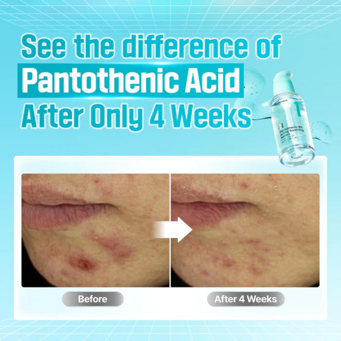 numbuzin No.1 Pantothenic B5 Active Soothing Serum 50ml numbuzin