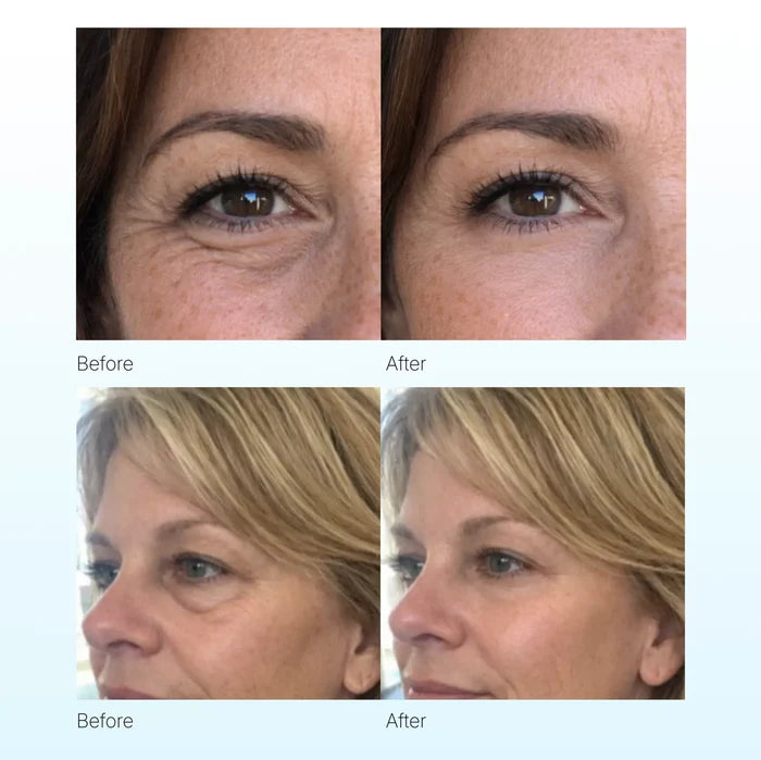 2 Minute Instant Eye Lift