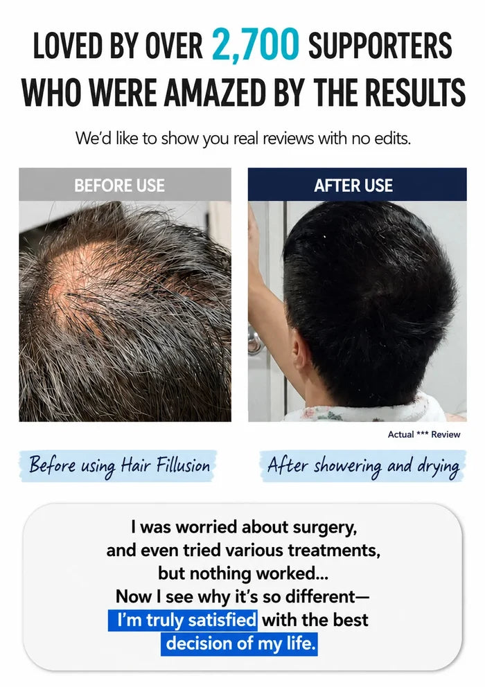 A promotional before-and-after graphic for a hair filling product. The top text reads 'LOVED BY OVER 2,700 SUPPORTERS WHO WERE AMAZED BY THE RESULTS.