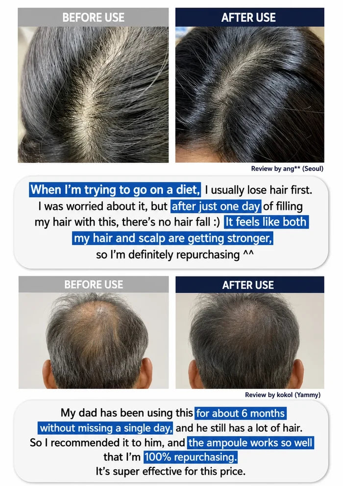 A collage of before-and-after hair growth results showing human scalp and hairline photos, with text reviews in English highlighting hair regrowth after use of an ampule product.