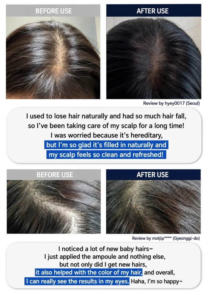 A before-and-after collage showing hair growth results on three different people. The top row shows close-up views of a scalp with thinning hair labeled 'BEFORE USE' and fuller, darker hair labeled 'AFTER USE'.