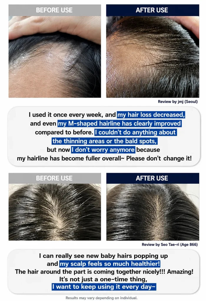 A before-and-after collage showing close-up hair growth results on three different users. The top row shows a hand parting hair in 'BEFORE USE' and 'AFTER USE' views.