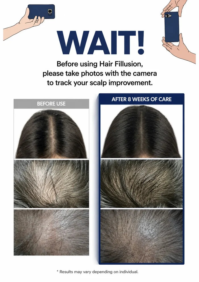 An informational comparison graphic for a hair filling product. It shows illustrated hands holding phones at the top, large text reading 'WAIT!', and before/after scalp photos under the heading 'Before using Hair Filling, please take photos with the camera to track your scalp improvement.