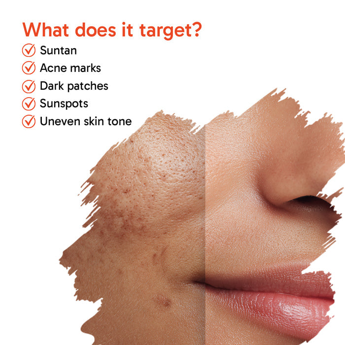8% Advanced De Tan SUN Reset Glow Exfoliating Toner 6% Glycolic, 2% Kojic, Niacinamide, Alpha Arbutin, Fights Sun Damage & Brightens Skin - Keya Seth Aromatherapy