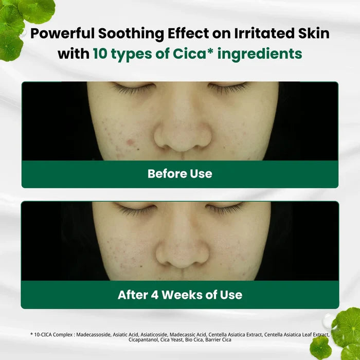 Dr.G R.E.D Blemish Clear Soothing Cream 70ml Dr.G R.E.D