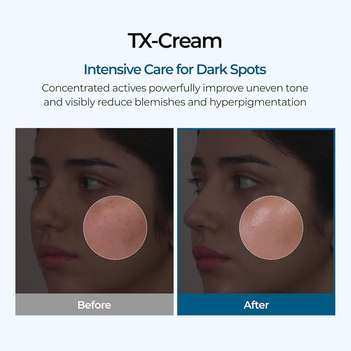 Dr.Melaxin TX Cream 50ml | VGLE Beauty Canada