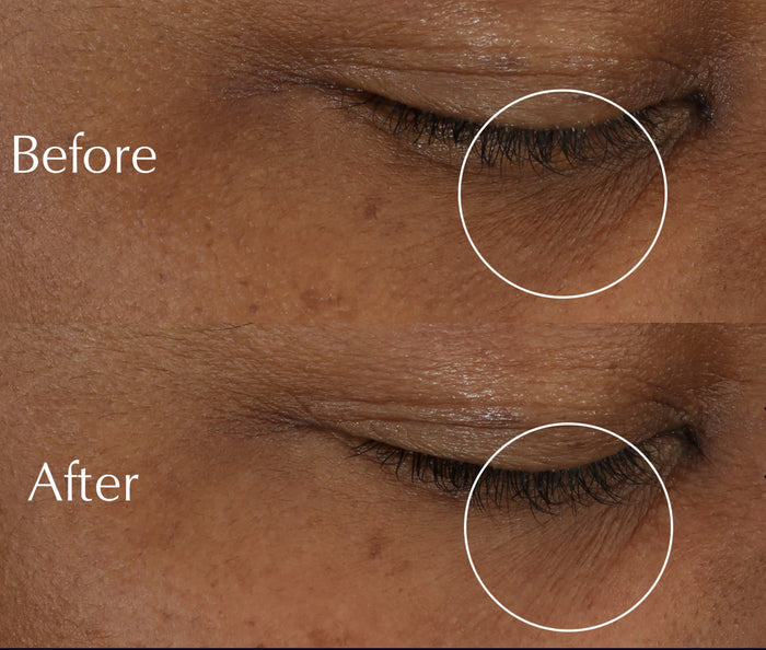 ESTEE LAUDER Advanced Night Repair Eye Supercharged Gel Cream كريم العين للعناية المزدوجة من استي لودر