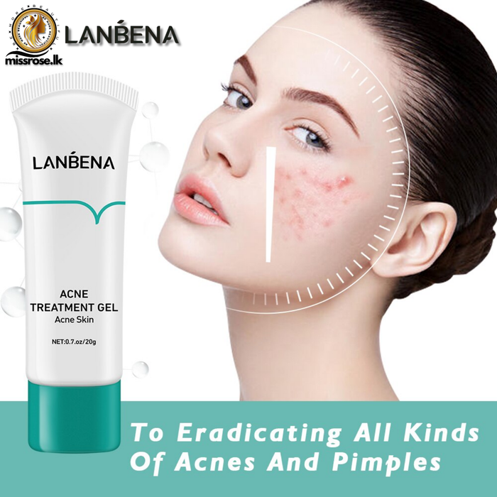 Lanbena  Acne Treatment Gel  20g