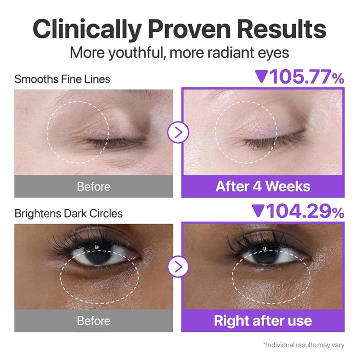 numbuzin No.9 NAD+ Retinol Eye Cream 10ml | VGLE Beauty Canada
