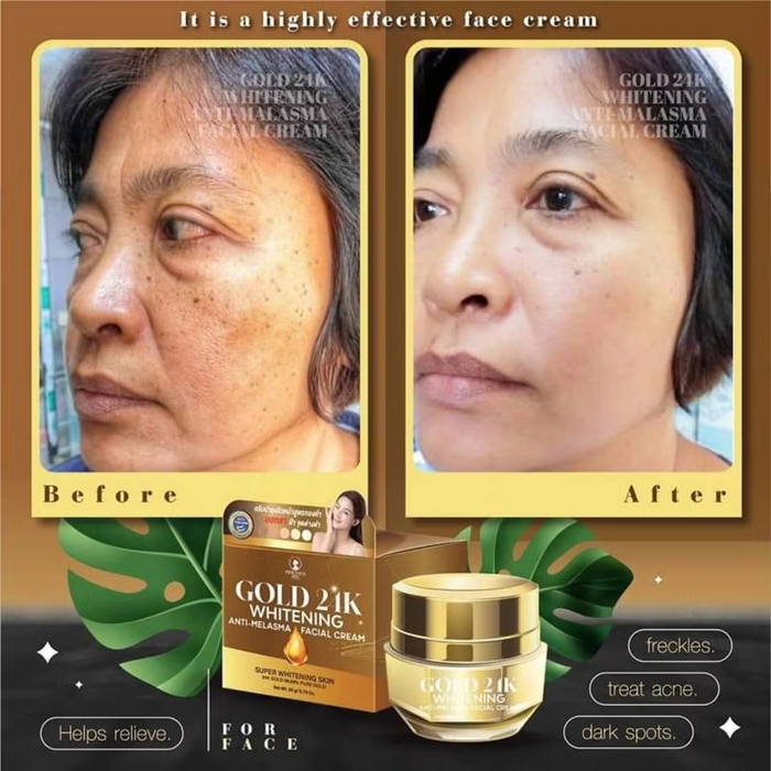 Precious Skin Gold 24K Whitening Anti - Melasma Facial Cream 15g كريم الوجه بريشوس سكين جولد 24 قيراط لتفتيح البشرة ومكافحة الكلف - Princess Cosmetics Qatar