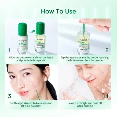 Skintific Acne Drying Lotion 10ml لوشن سكينتيفيك لتجفيف حب الشباب - Princess Cosmetics Qatar