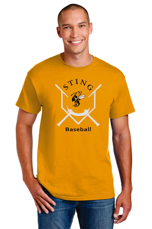 Sting Base Tee- matte or glitter- 4 colors