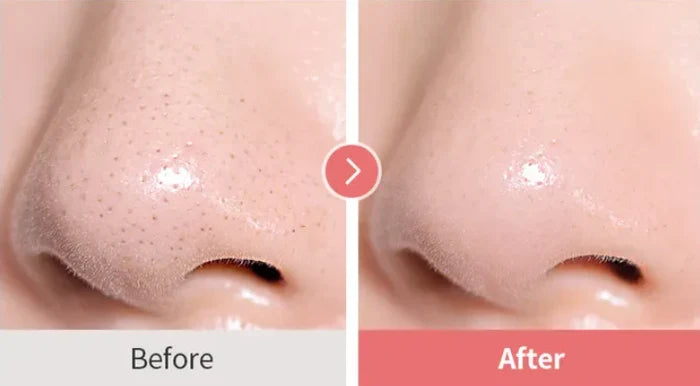 TOCOBO Calamine Pore Control Cleansing Oil غسول زيتي للبشرة بتركيبة نباتية