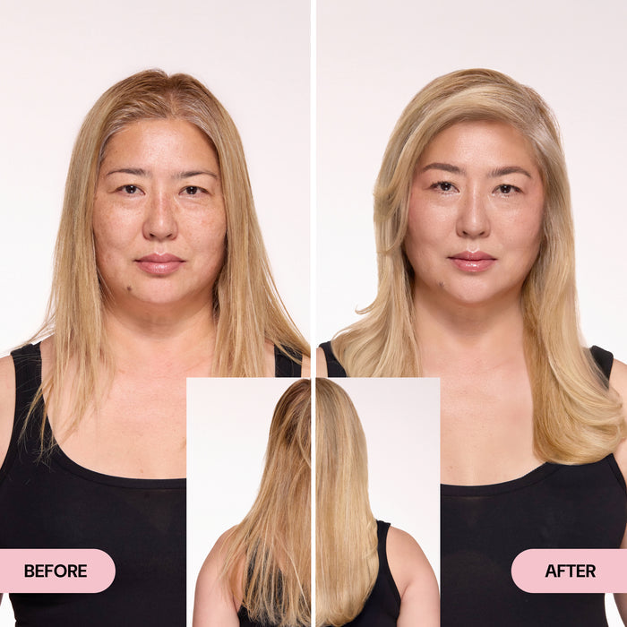 Before & After
