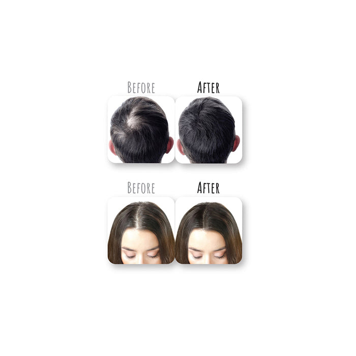 NICKA K before and after images showing scalp coverage with dark brown hair concealer for thinning hair