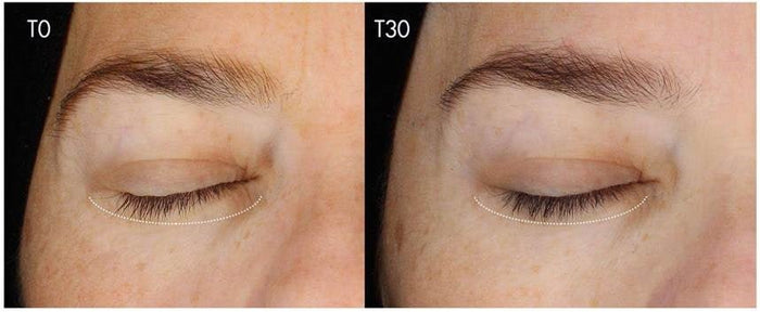 VOLUMI - LOOK - Serum Pentru Cresterea Genelor Si Sprancenelor - skinseen.ro